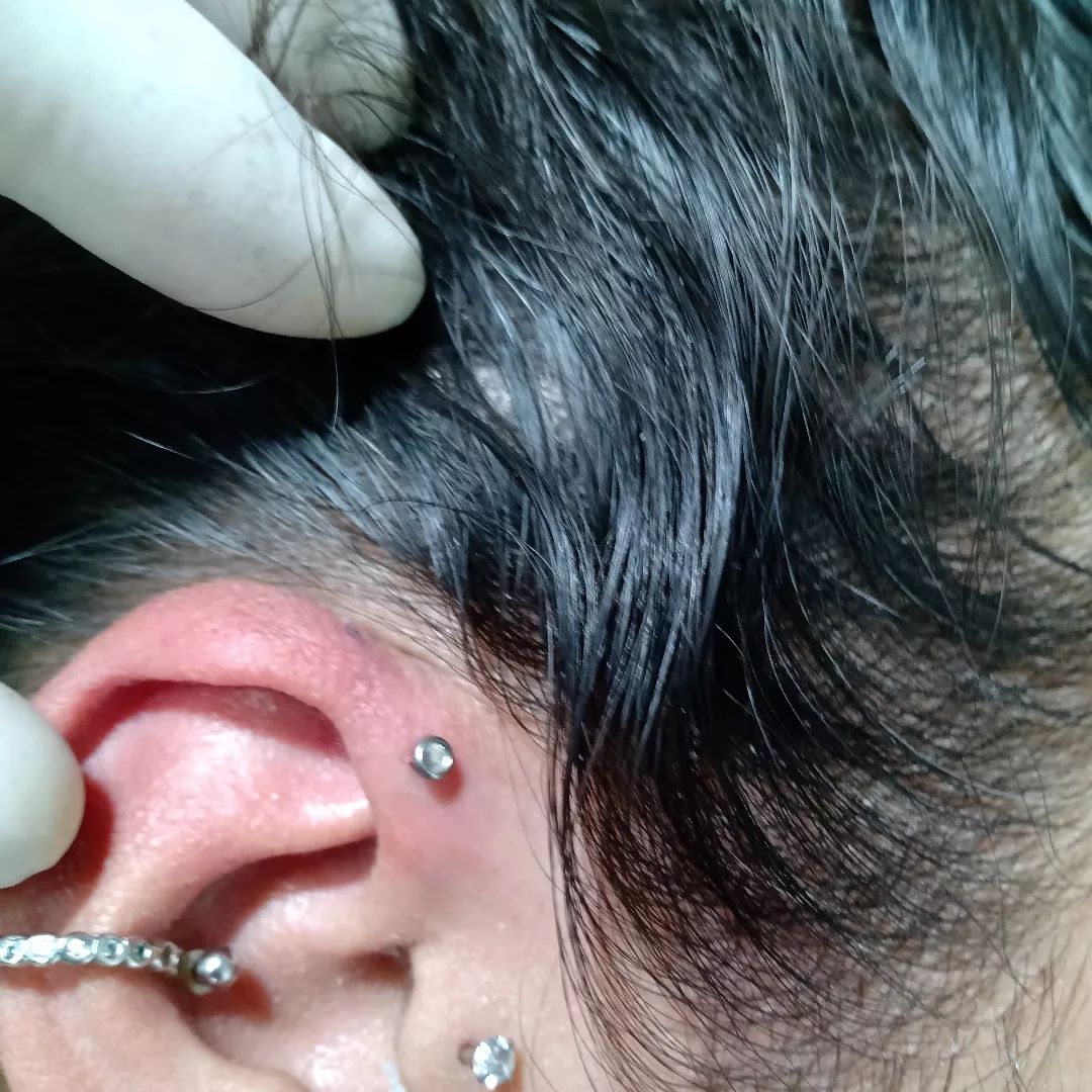 A close-up of a person's ear receiving a piercing at Mambrinos Studio Tatto.